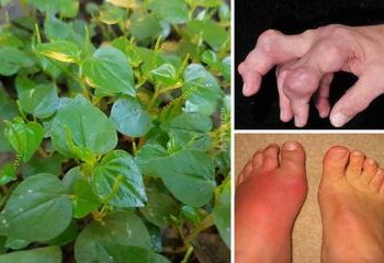 Obat Herbal Asam Urat