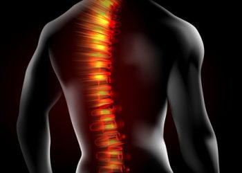 Cara Mengobati Kelainan Pada Tulang