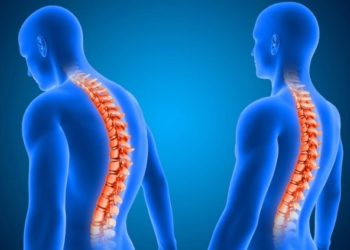 jenis jenis kelainan pada tulang