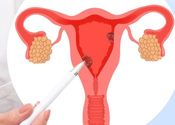 Penyebab Kanker Rahim Yang Perlu Diperhatikan Oleh Wanita