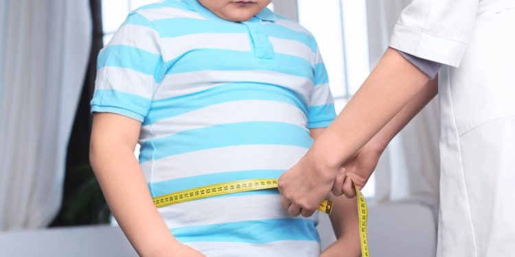 Cara Mencegah Obesitas Pada Anak-anak